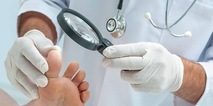 The doctor examines a patient's foot with a tip with a magnifying glass