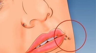 The reasons for the appearance of warts